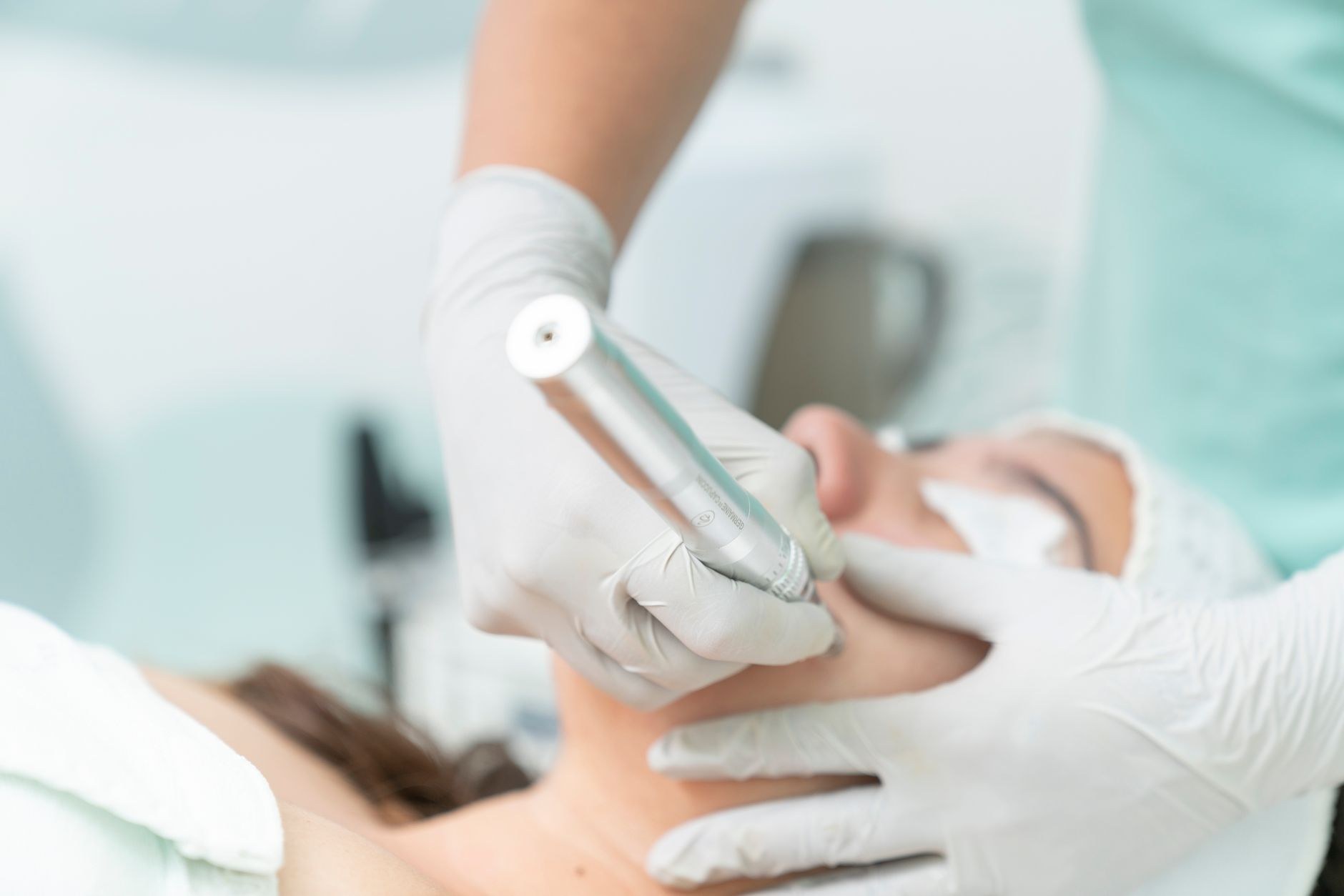Skin needling treatment